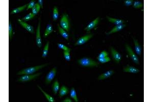 Immunofluorescence staining of Hela cells with ABIN7152610 at 1:100, counter-stained with DAPI.