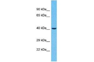 Host:  Rabbit  Target Name:  ZNF232  Sample Type:  Breast Tumor lysates  Antibody Dilution:  1. (ZNF232 anticorps  (C-Term))