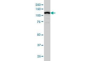 GABBR1 monoclonal antibody (M01), clone 2D7 Western Blot analysis of GABBR1 expression in IMR-32 .
