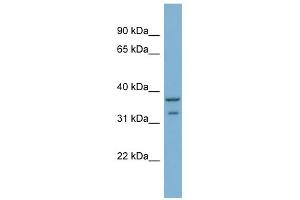 WB Suggested Anti-RALGPS2 Antibody Titration: 0. (RALGPS2 anticorps  (C-Term))