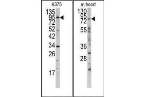 Image no. 1 for anti-Myosin Light Chain Kinase (MYLK) (N-Term) antibody (ABIN360382) (MYLK anticorps  (N-Term))