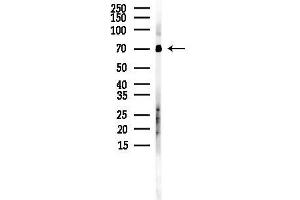 Western blot analysis of lysates from Mouse liver, using IKZF3 Antibody at 1/1000 dilution.