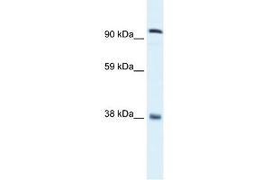 WB Suggested Anti-EVI1 Antibody Titration: 0.