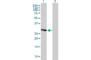 Western Blot analysis of C21orf7 expression in transfected 293T cell line by C21orf7 MaxPab polyclonal antibody. (MAP3K7CL anticorps  (AA 1-242))
