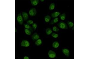 anti-Transducin (Beta)-Like 1 X-Linked Receptor 1 (TBL1XR1) antibody