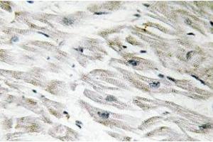 Immunohistochemistry (IHC) analyzes of CPI-17 antibody in paraffin-embedded human heart tissue. (CPI-17 anticorps)