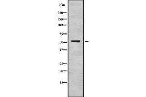 Western blot analysis of CPA6 using HepG2 whole cell lysates (CPA6 anticorps  (Internal Region))