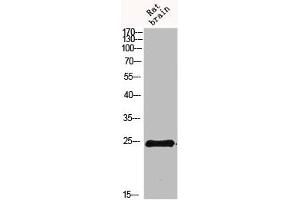 Western blot analysis of 293T Hela VEC KB mouse-kidney lysate, antibody was diluted at 500. (IL-19 anticorps  (AA 51-100))