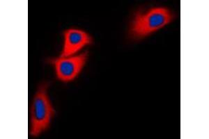 Immunofluorescent analysis of BNIP2 staining in HEK293T cells.