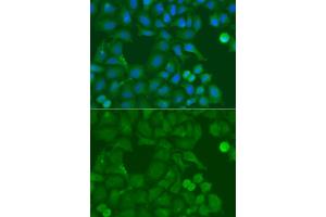 Immunofluorescence analysis of A549 cells using SSX5 antibody. (SSX5 anticorps)