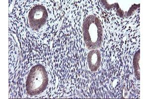 Image no. 6 for anti-Cancer/testis Antigen 1B (CTAG1B) antibody (ABIN1499894) (CTAG1B anticorps)