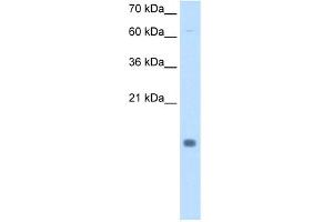 WB Suggested Anti-CSTB Antibody Titration:  0. (CSTB anticorps  (N-Term))