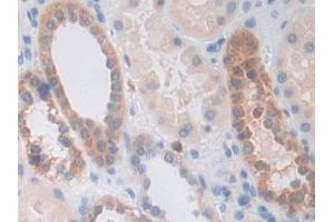 DAB staining on IHC-P; Samples: Human Kidney Tissue