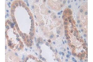 DAB staining on IHC-P; Samples: Human Kidney Tissue (PPIF anticorps  (AA 45-196))