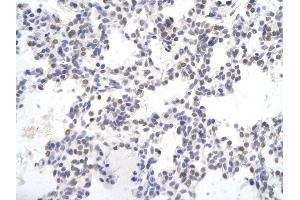 Rabbit Anti-SMAD4 antibody        Paraffin Embedded Tissue:  Human Lung cell   Cellular Data:  Epithelial cells of renal tubule  Antibody Concentration:   4.