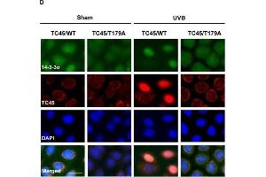 14-3-3σ transports TC45 into the keratinocyte nucleus following UVB irradiation through direct binding3PC keratinocytes overexpressing A.