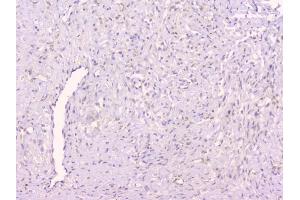 IHC analysis of TNFRSF11B using anti-TNFRSF11B antibody (ABIN7600875).