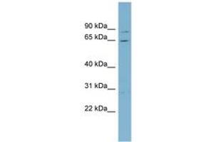 Image no. 1 for anti-Replication Protein A1, 70kDa (RPA1) (AA 215-264) antibody (ABIN6742105) (RPA1 anticorps  (AA 215-264))