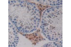 Used in DAB staining on fromalin fixed paraffin- embedded Kidney tissue (PPHLN1 anticorps  (AA 1-381))
