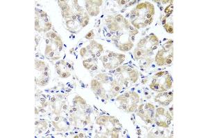 Immunohistochemistry of paraffin-embedded human stomach using ALKBH4 antibody (ABIN5974944) at dilution of 1/100 (40x lens). (ALKBH4 anticorps)