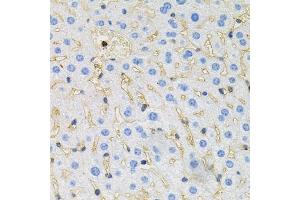 Immunohistochemistry of paraffin-embedded mouse liver using Tau antibody (ABIN3021441, ABIN3021442, ABIN3021443 and ABIN6215045) at dilution of 1:100 (40x lens). (MAPT anticorps  (AA 1-100))