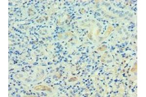 Immunohistochemistry of paraffin-embedded human kidney tissue using ABIN7164230 at dilution of 1:100 (PSG1 anticorps  (AA 180-419))
