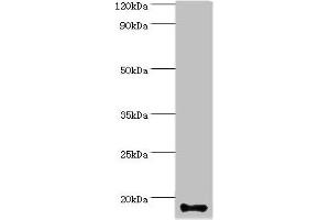 Western blot All lanes: Calmodulin-like protein 5 antibody at 12 μg/mL + A431 whole cell lysate Secondary Goat polyclonal to rabbit IgG at 1/10000 dilution Predicted band size: 16 kDa Observed band size: 16 kDa (CALML5 anticorps  (AA 1-146))