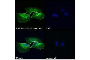 ABIN7013881 Immunofluorescence analysis of paraformaldehyde fixed U2OS cells, permeabilized with 0. (Somatostatin anticorps  (AA 58-70))