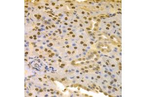 Immunohistochemistry of paraffin-embedded rat kidney using COPS5 antibody at dilution of 1:100 (x400 lens). (COPS5 anticorps)