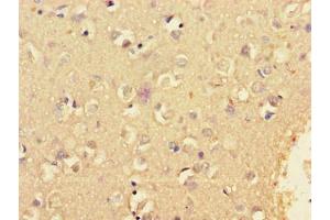 Immunohistochemistry of paraffin-embedded human brain tissue using ABIN7157745 at dilution of 1:100 (KCNIP4 anticorps  (AA 1-250))