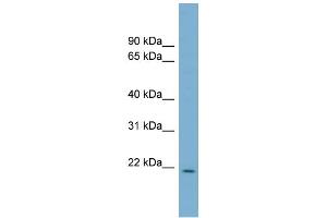 WB Suggested Anti-CUTA Antibody Titration:  0. (CUTA anticorps  (Middle Region))