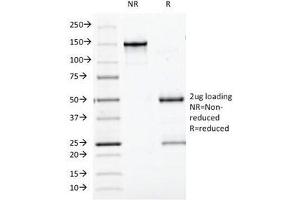 SDS-PAGE Analysis of Purified, BSA-Free Bcl10 Antibody (clone BL10/411). (BCL10 anticorps  (AA 122-168))