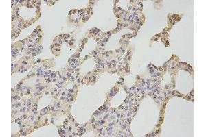 Immunohistochemistry (IHC) image for anti-Calcium/calmodulin-Dependent Protein Kinase IV (CAMK4) antibody (ABIN1876492)