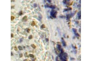 Used in DAB staining on fromalin fixed paraffin-embedded Spleen tissue