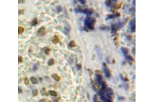 Used in DAB staining on fromalin fixed paraffin-embedded Spleen tissue (NUP160 anticorps  (AA 1211-1436))