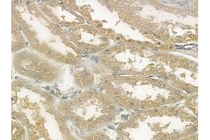 ABIN6260524 and ABIN6272568 at 1/100 staining human normal kidney tissue by IHC-P. (CCBE1 anticorps  (Internal Region))