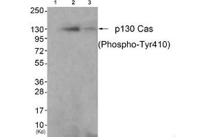 Western blot analysis of extracts from K562 cells (Lane 2) and 3T3 cells (Lane 3), using P130 Cas(Phospho-Tyr410) Antibody.