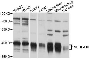 Western blot analysis of extracts of various cell lines, using NDUFA10 antibody (ABIN6003821) at 1/1000 dilution. (NDUFA10 anticorps)