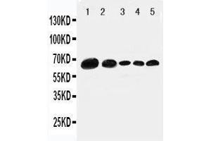 Anti-Paxillin antibody, Western blotting Lane 1: 293T Cell Lysate Lane 2: HELA Cell Lysate Lane 3: MCF-7 Cell Lysate Lane 4: MM231 Cell Lysate Lane 5: JUKAT Cell Lysate