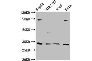 Western Blot Positive WB detected in: HepG2 whole cell lysate, NIH/3T3 whole cell lysate, A549 whole cell lysate, Hela whole cell lysate All lanes: DUSP4 antibody at 1:1000 Secondary Goat polyclonal to rabbit IgG at 1/50000 dilution Predicted band size: 43, 33 kDa Observed band size: 33 kDa (DUSP4 anticorps  (AA 109-198))