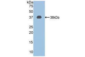 Western blot analysis of recombinant Mouse CAPN1.