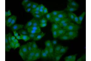 Immunofluorescence staining of HepG2 cells with ABIN7167158 at 1:166, counter-stained with DAPI.