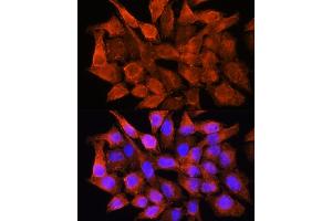 Immunofluorescence analysis of HeLa cells using AMT Rabbit pAb (ABIN6127345, ABIN6136850, ABIN6136851 and ABIN6225250) at dilution of 1:100.