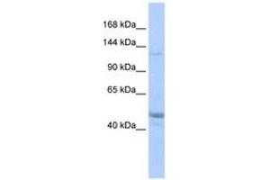 KIAA0319L anticorps  (AA 575-624)