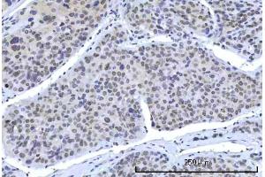 IHC analysis of RBM15B using anti-RBM15B antibody (ABIN7600219). (RBM15B anticorps  (AA 164-890))