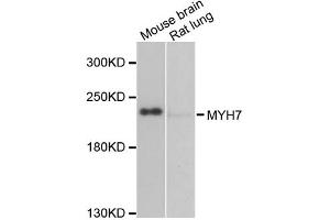 Western blot analysis of extracts of various cell lines, using MYH7 antibody (ABIN2563999) at 1:1000 dilution. (MYH7 anticorps)