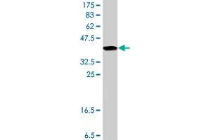 Western Blot detection against Immunogen (37.