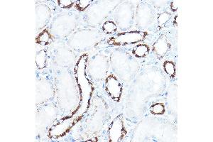 Immunohistochemistry of paraffin-embedded rat kidney using HK1 Rabbit pAb (ABIN3021308, ABIN3021309, ABIN3021310 and ABIN6214823) at dilution of 1:150 (40x lens).