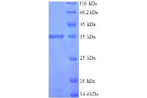 SDS-PAGE (SDS) image for Interferon, alpha 1 (IFNA1) (AA 24-189) protein (His-SUMO Tag) (ABIN5711119)