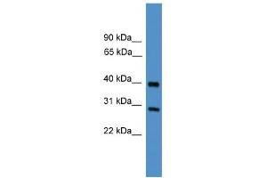 WB Suggested Anti-TIMP2 Antibody Titration: 0. (TIMP2 anticorps  (Middle Region))